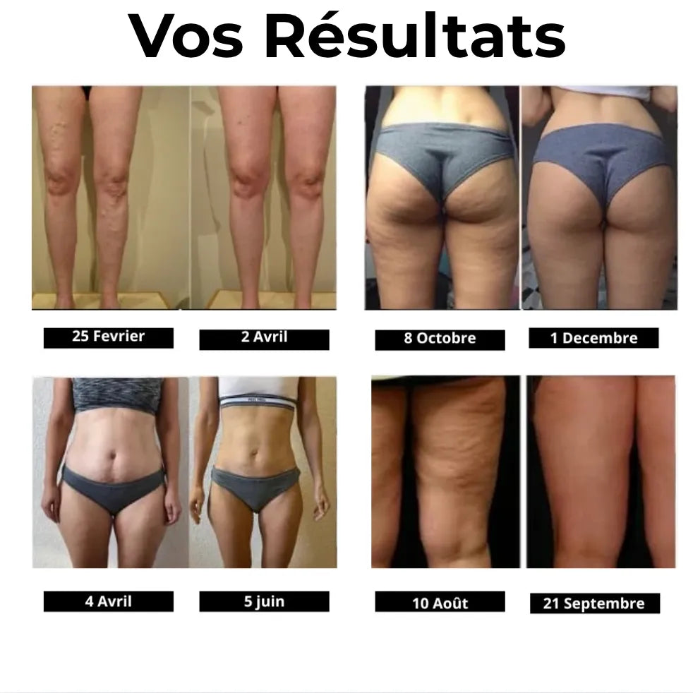 Sculptiva | Sculptez votre silhouette sans effort